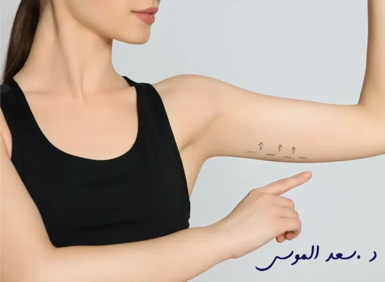 عملية شد الذراعين من الباط