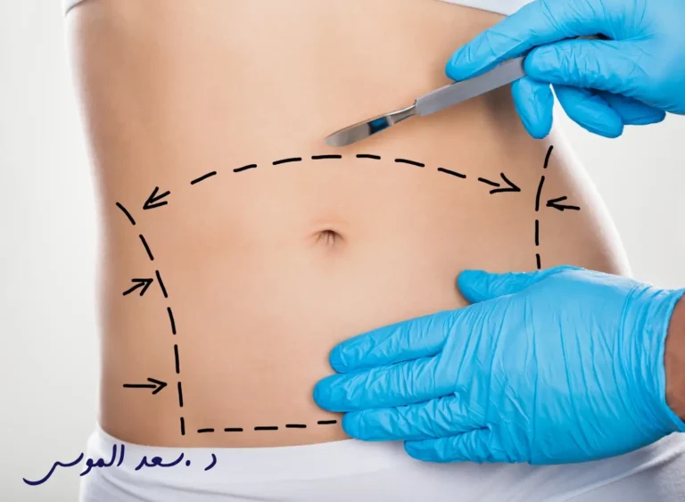 افضل دكتور شد بطن في الرياض