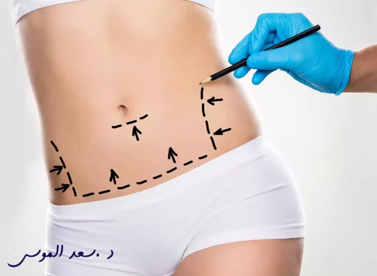 افضل دكتور نحت الجسم في الرياض
