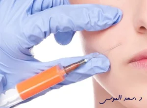 حقن الدهون الذاتية بالوجه