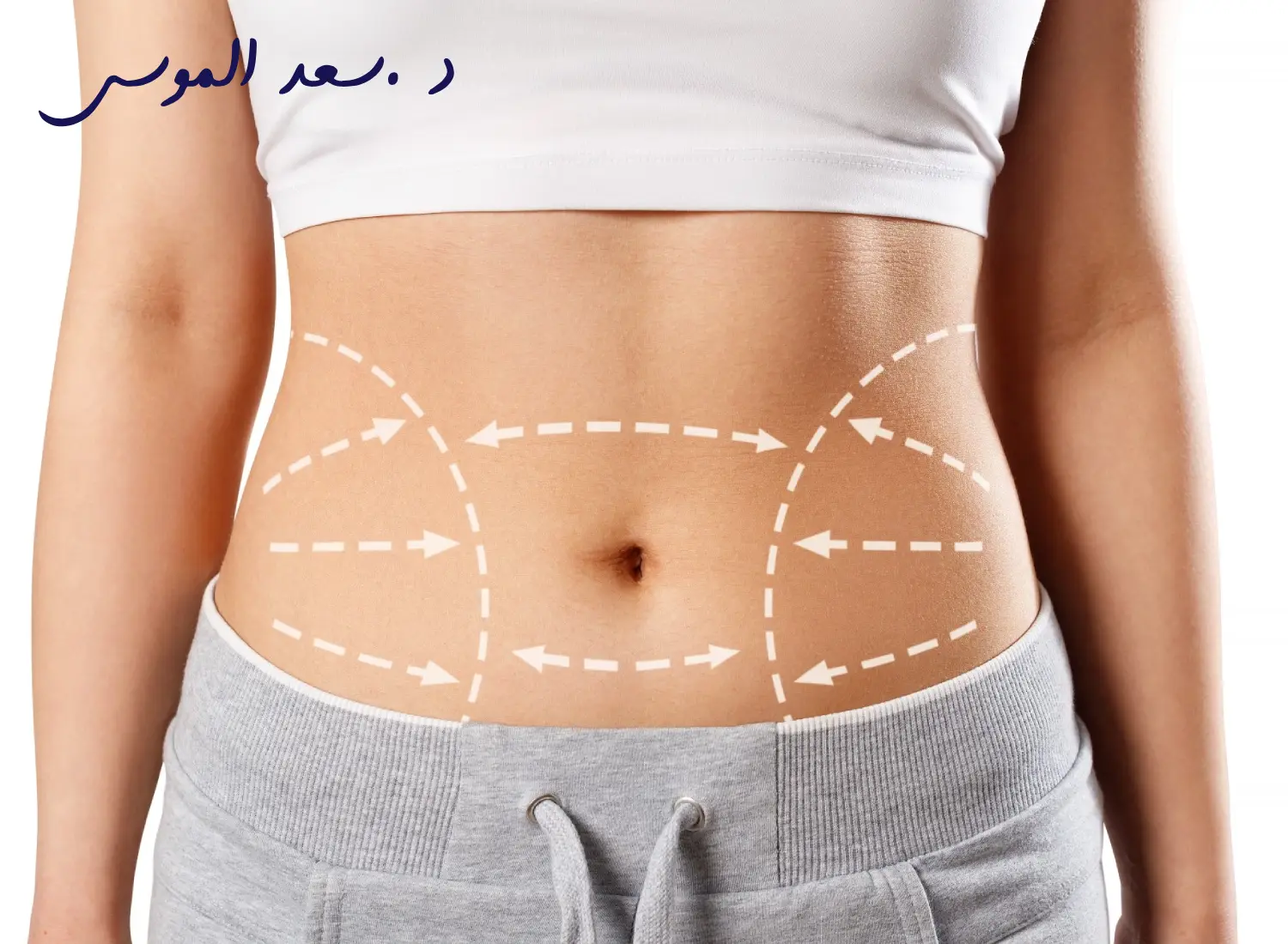 عملية شفط الدهون