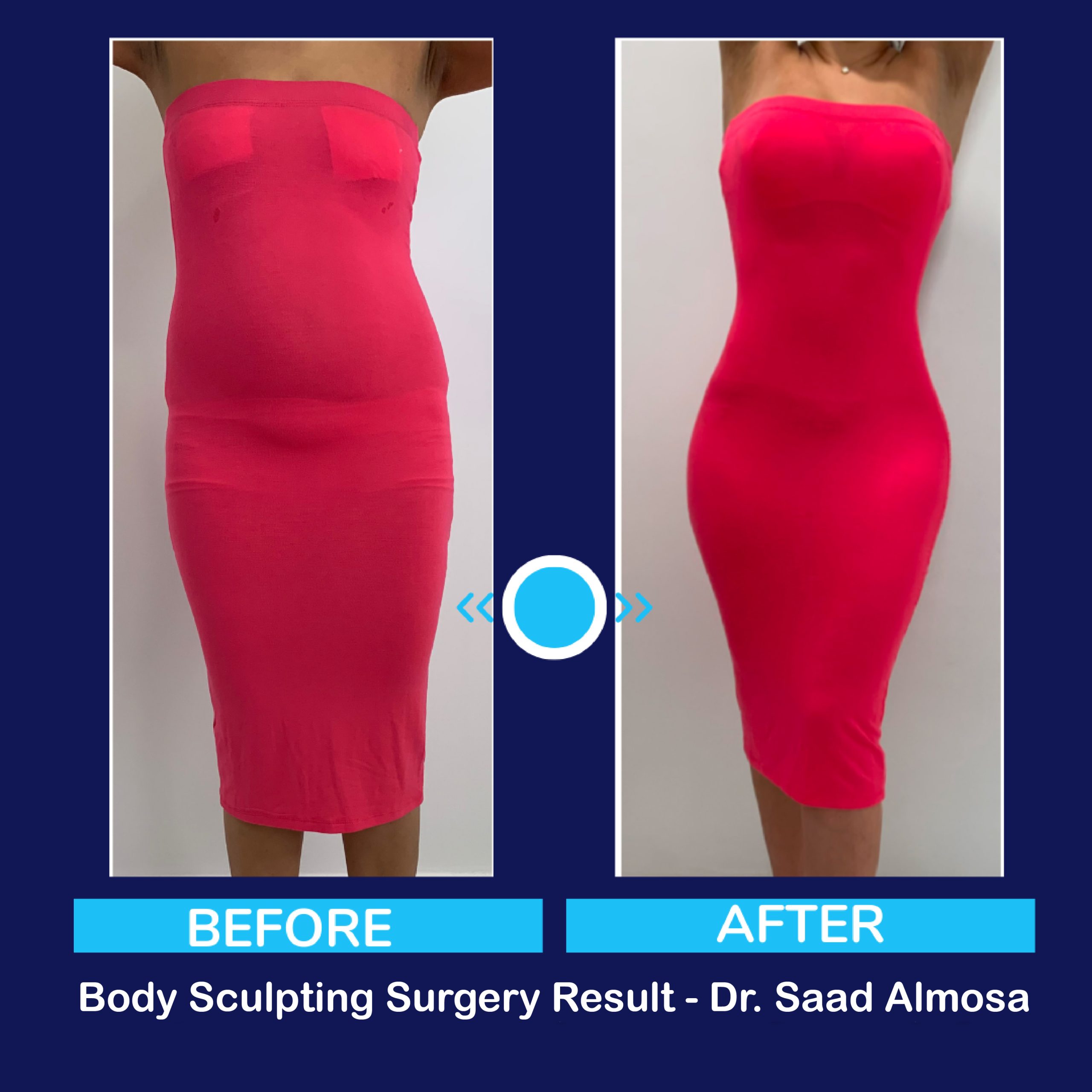 Before and after case result one