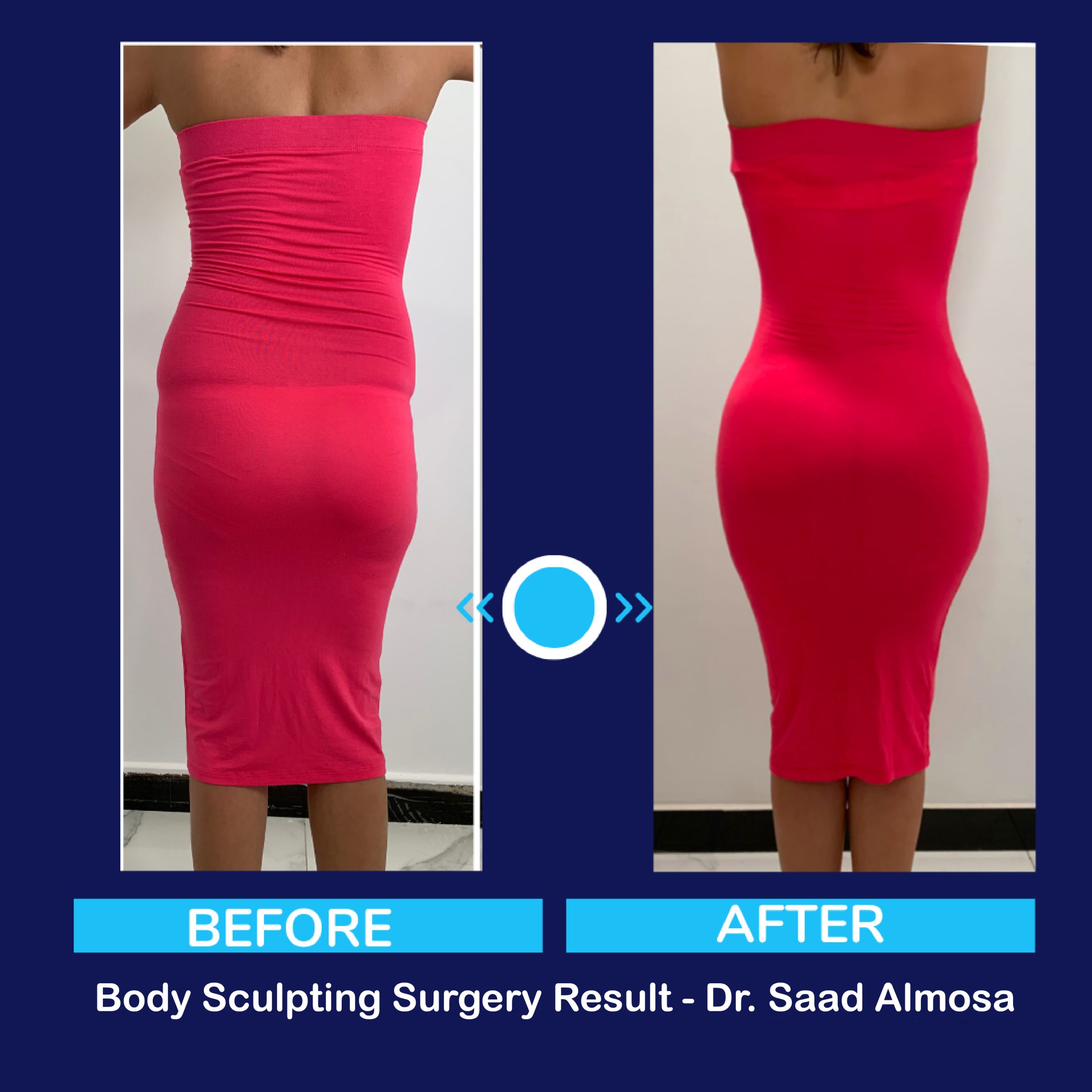 Before and after case result two