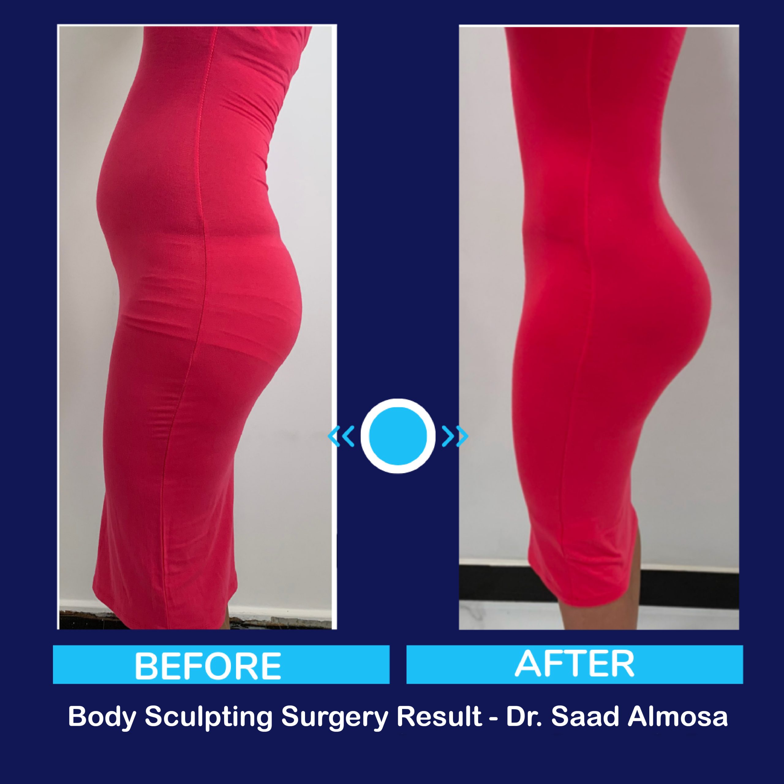 Before and after case result three