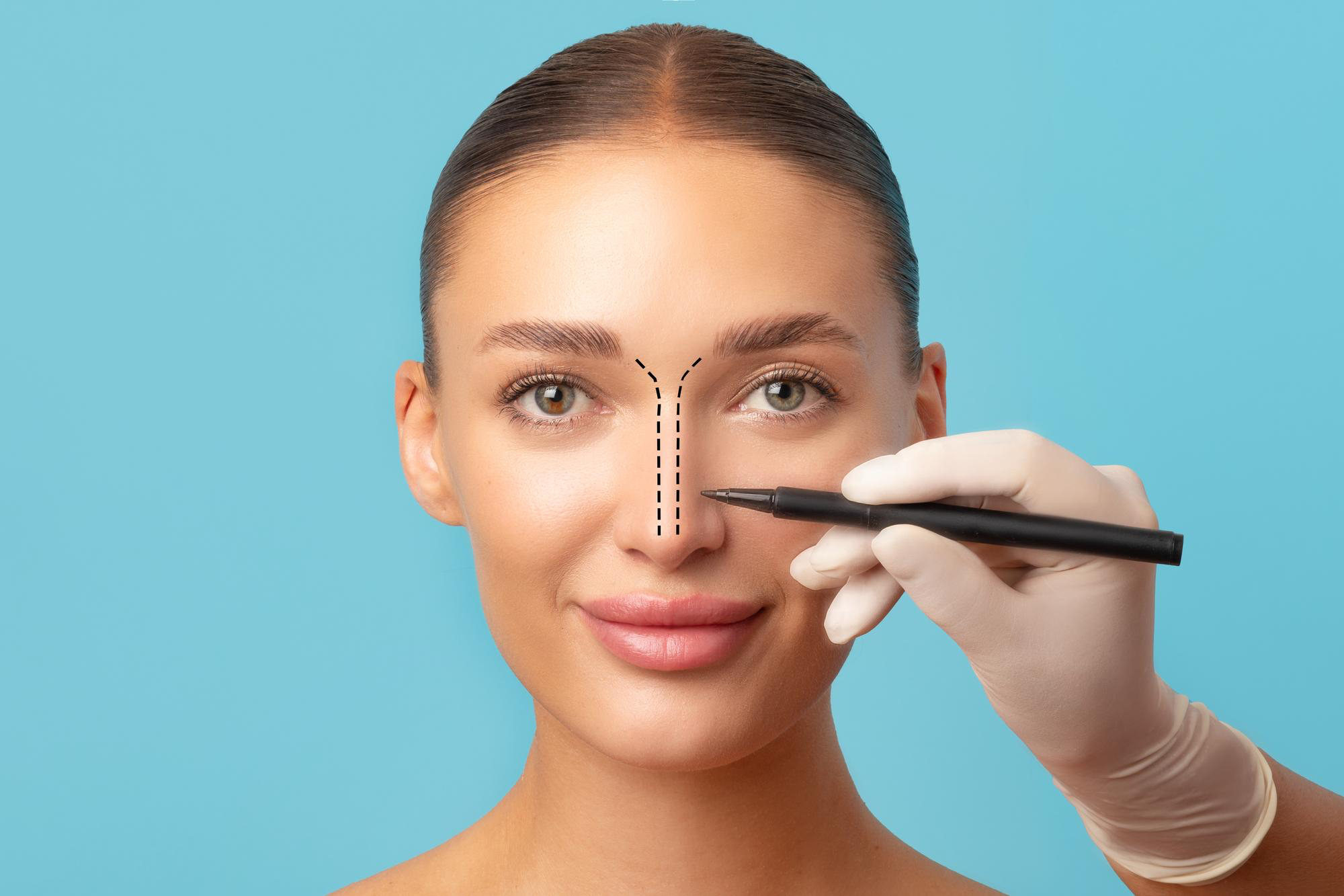 جراحة تجميل الأنف
